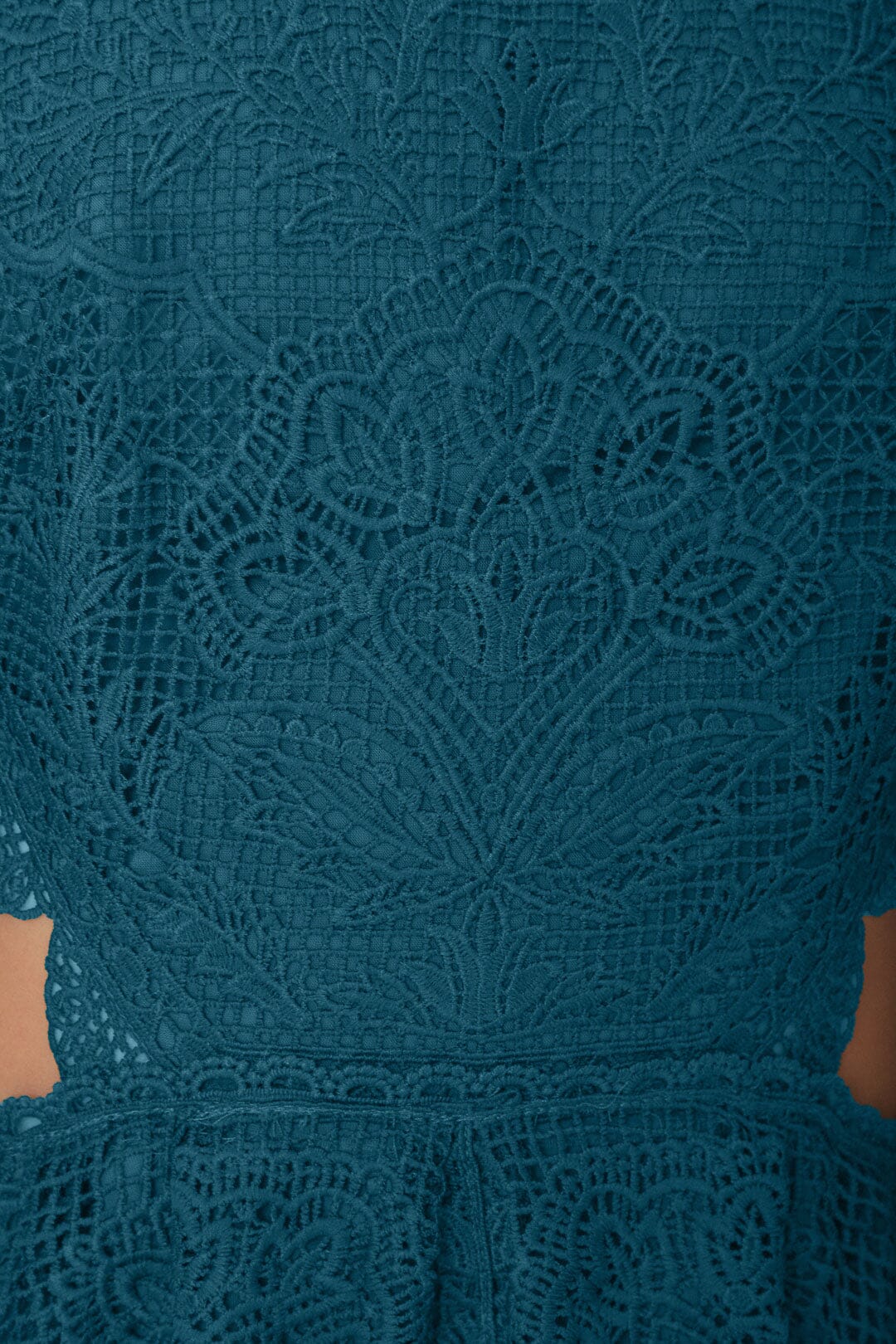 Green Guipire Cut-Out Midi Dress – FARM Rio